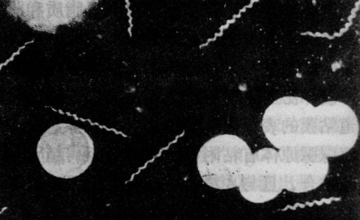 检验科 | Syphilis，“梅”完“梅”了