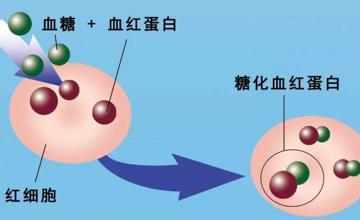 检验科 | 一文了解糖化血红蛋白