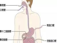 重症医学科 | ICU患者的营养支持