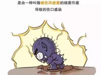 急诊医学科 | 一根牙签引起的致命伤——浅谈破伤风