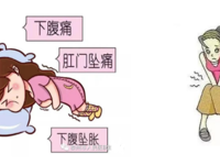 妇科 | 反反复复的盆腔炎，太难缠！