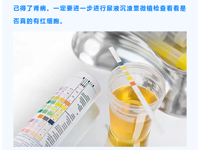 肾内科 | 保护肾脏小知识