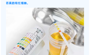 肾内科 | 保护肾脏小知识