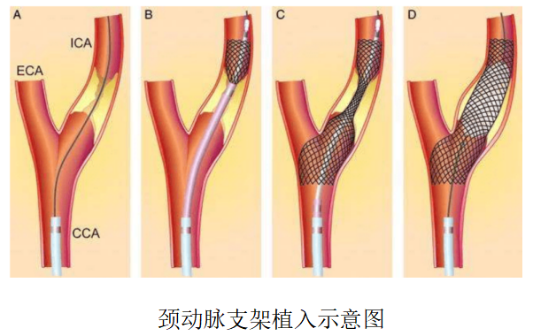 添加图片描述 添加图片描述