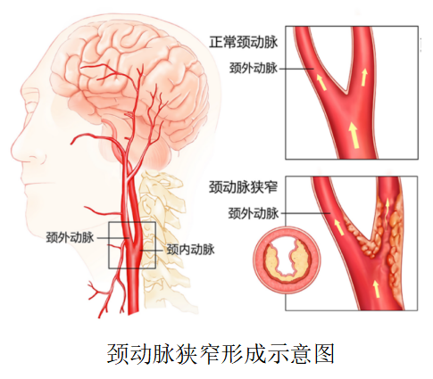 添加图片描述 添加图片描述