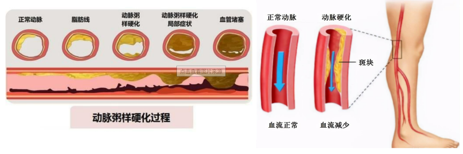 添加图片描述 添加图片描述