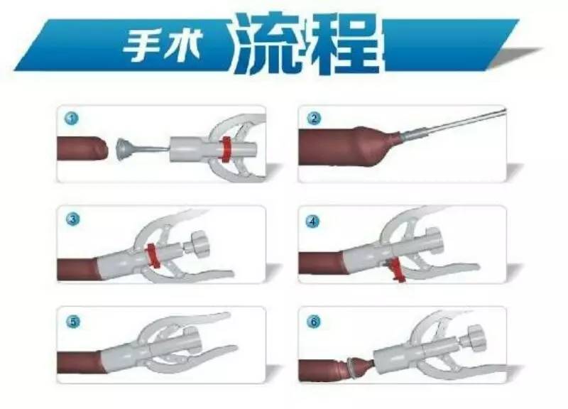 添加图片描述 添加图片描述