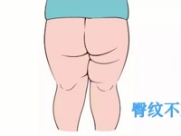 超声医学科 | 医生教您读报告：小儿髋关节篇