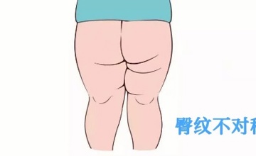 超声医学科 | 医生教您读报告：小儿髋关节篇