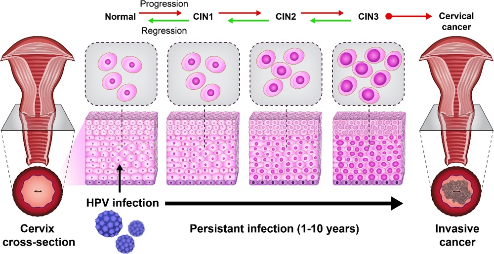 Frontiers | An Update on Human Papilloma Virus Vaccines: History, Types, Protection, and Efficacy