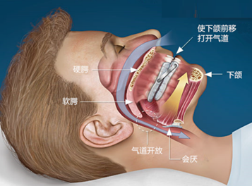 D:\Users\Xiuhong Pang\Desktop\1.png